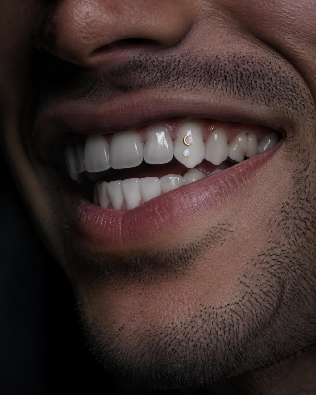 Macro close-up of a smile wearing a tiny gold moon and opal tooth gem